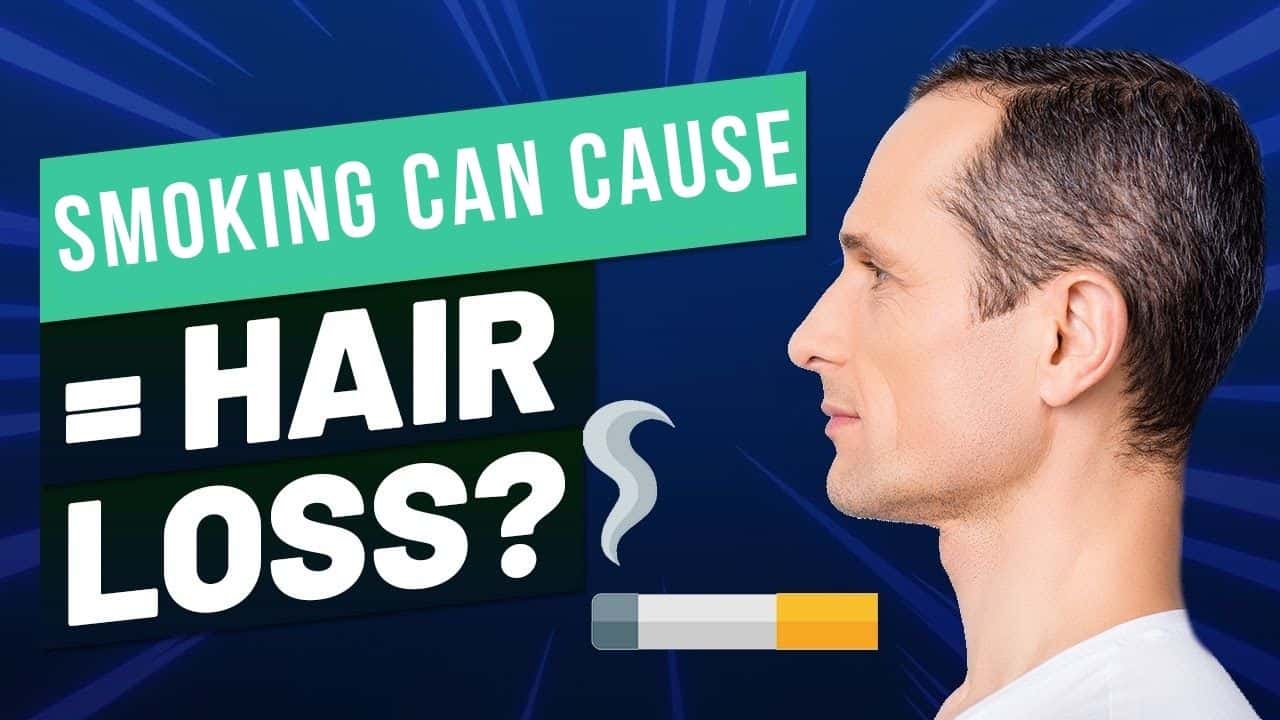 Smoking Can Cause Your Hair Loss