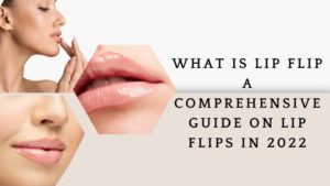 lip flip