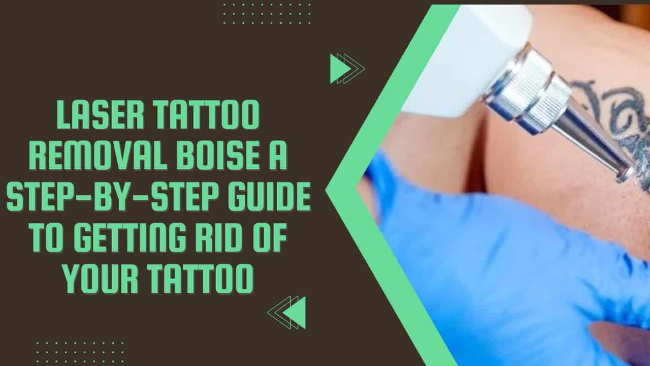 Laser Tattoo Removal Boise