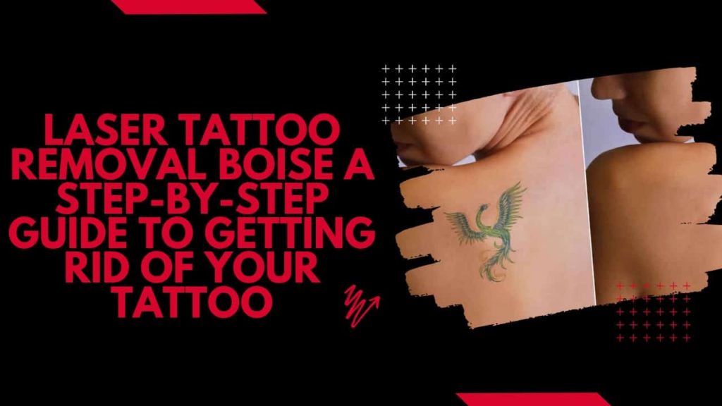 Laser Tattoo Removal Boise