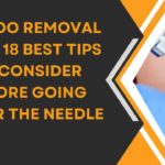 Laser Tattoo Removal Boise: A Step-by-Step Guide to Getting Rid of Your Tattoo